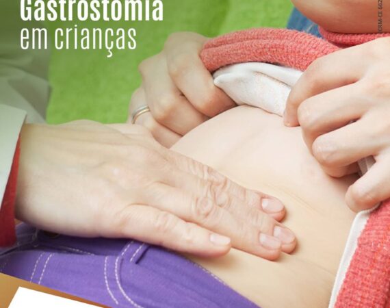 Gastrostomia - Dr. Aldo Melo