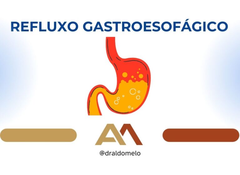 Refluxo gastroesofágico em crianças - Prof. Aldo Melo