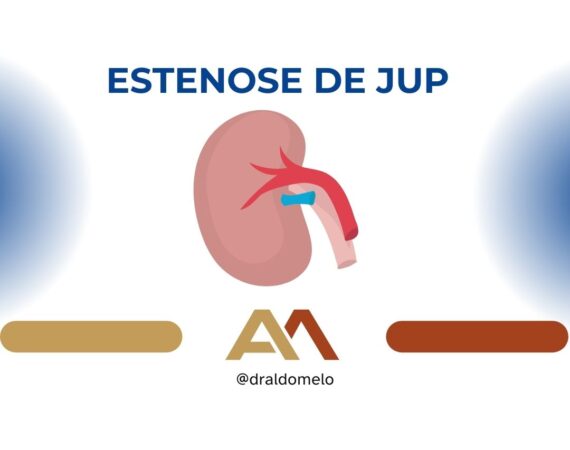 Estenose de JUP em crianças - Dr. Aldo Melo
