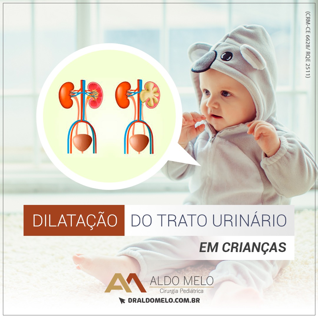 Dilatação do trato urinário - Dr. Aldo Melo - Cirurgia e Urologia Pediátrica