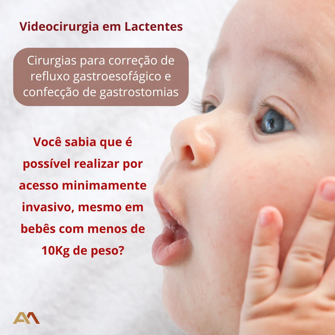 Dr. Aldo Melo - Cirurgia Pediátrica- vídeolaparoscopia - Fortaleza