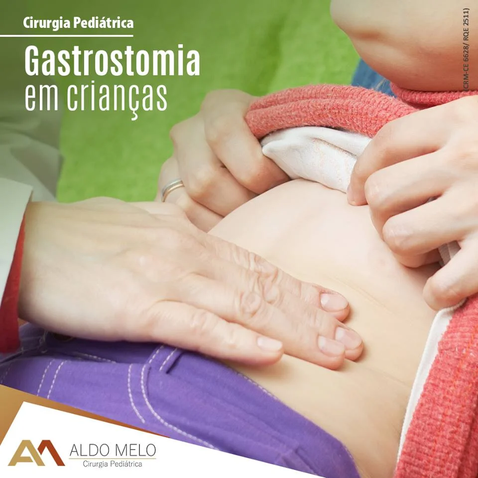 Gastrostomia em crianças - Dr. Aldo Melo - Cirurgia Pediátrica - Fortaleza - Ceará