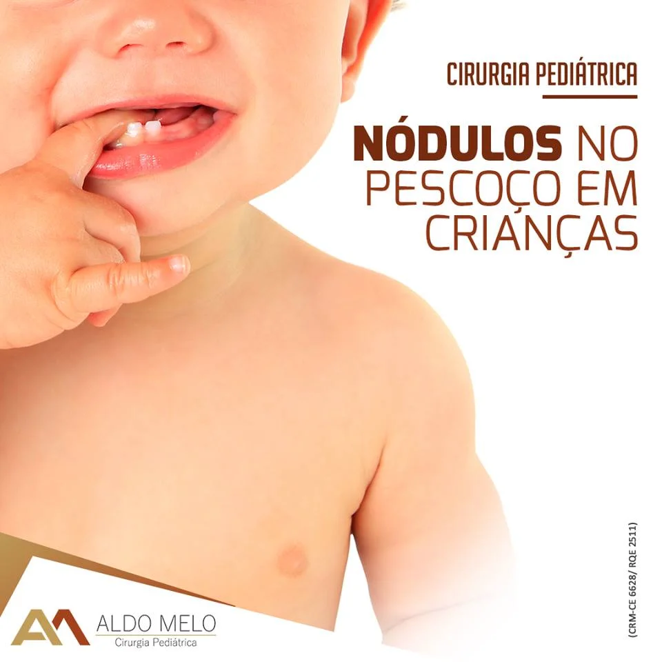 Lesões cervicais em crianças - Dr. Aldo Melo