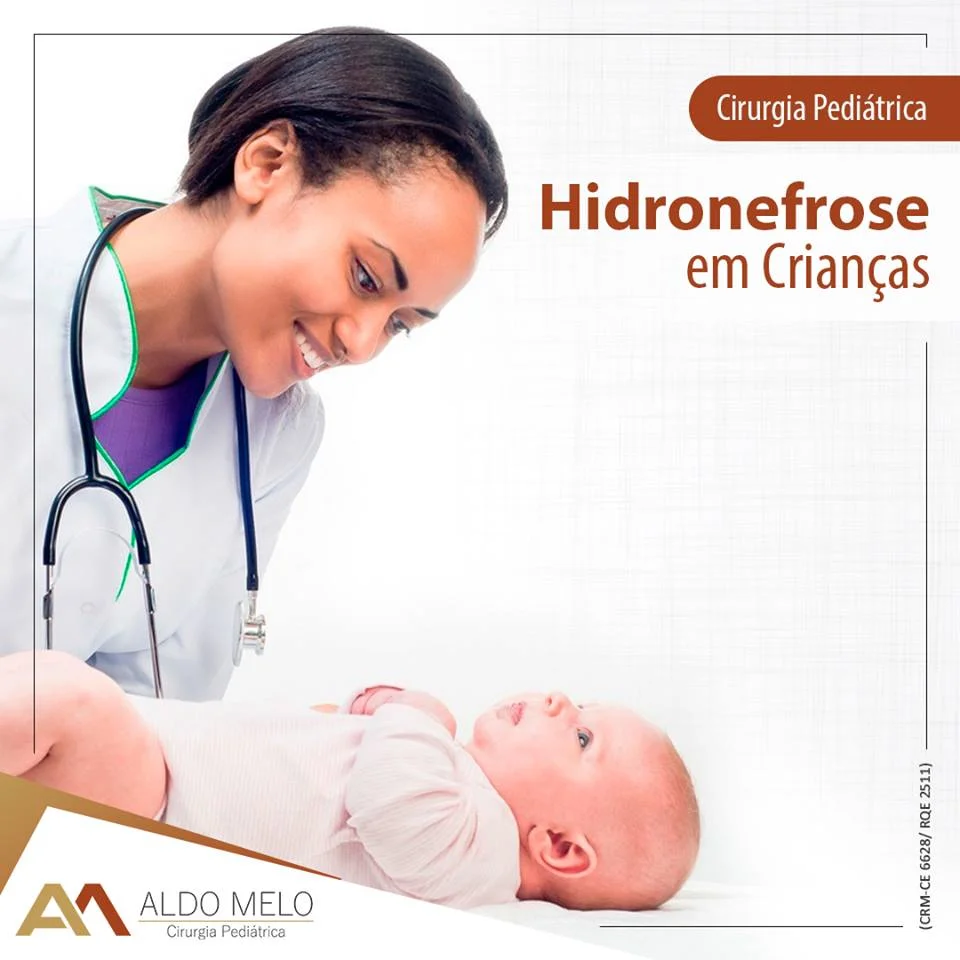 Dilatação do trato urinário - Dr. Aldo Melo - Cirurgia e Urologia Pediátrica